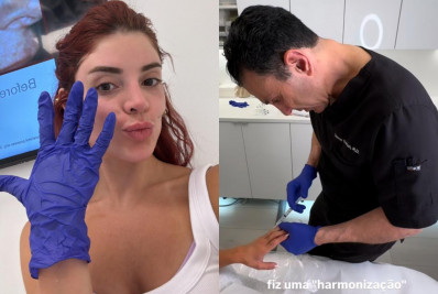 Gkay realiza harmonização das mãos com médico de Kim Kardashian em LA