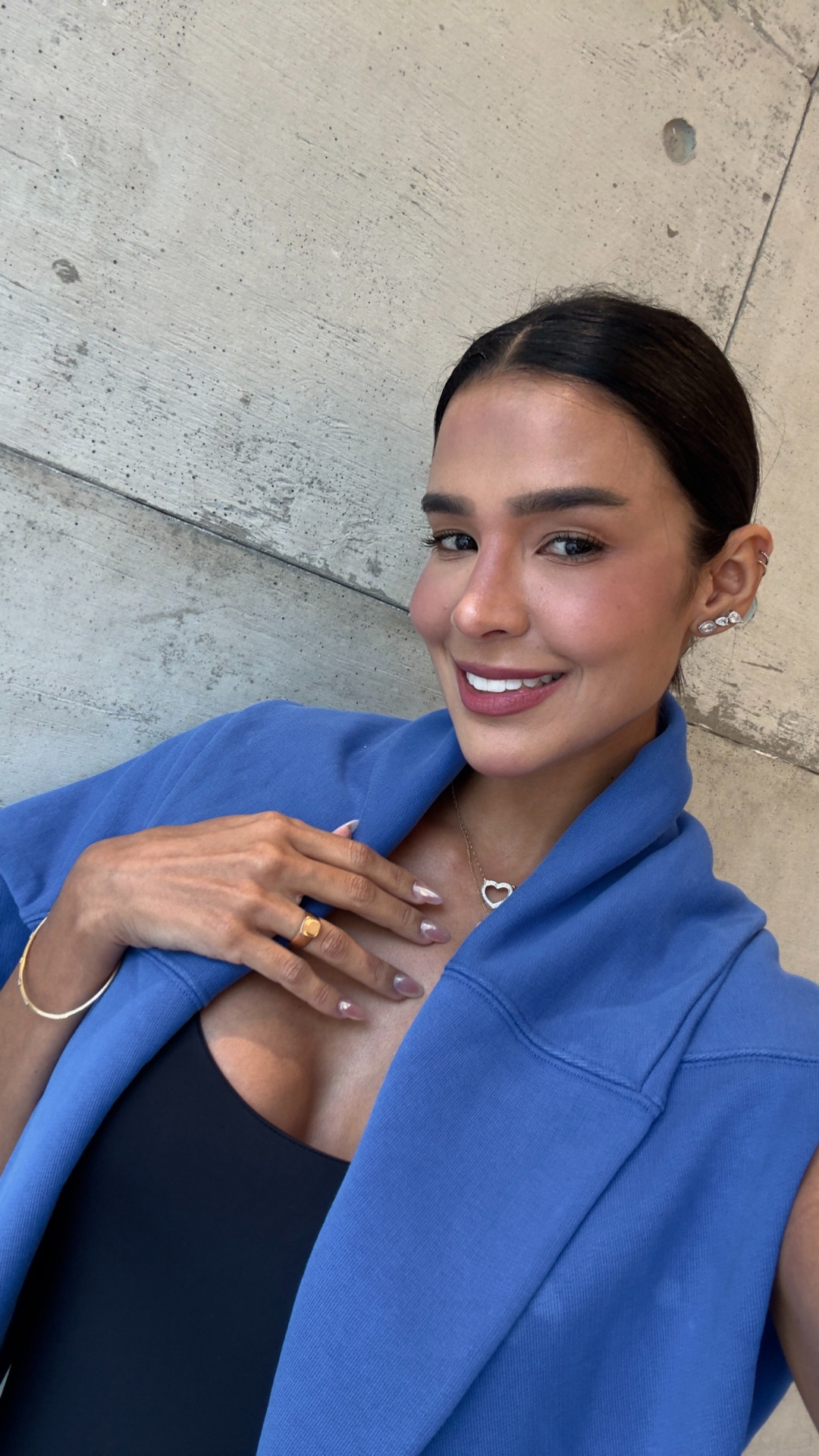 Kerline Cardoso mostrou boca natural - Divulgação