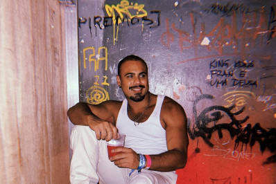 Ex-BBB Marcus Vinicius passa por 12h de cirurgia em novo transplante capilar