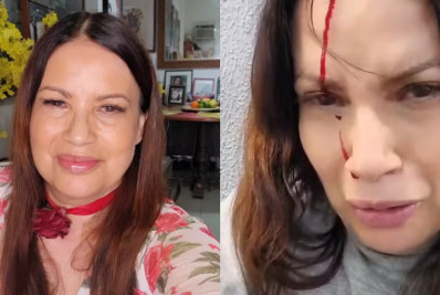 Isadora Ribeiro sofre acidente com carro e aparece sangrando na web