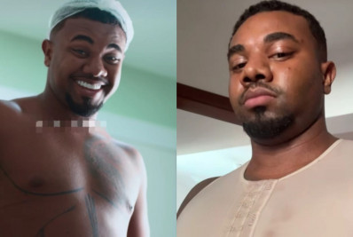 Ex-BBB Davi Brito mostra resultado de lipo HD: 'Surpreendente'
