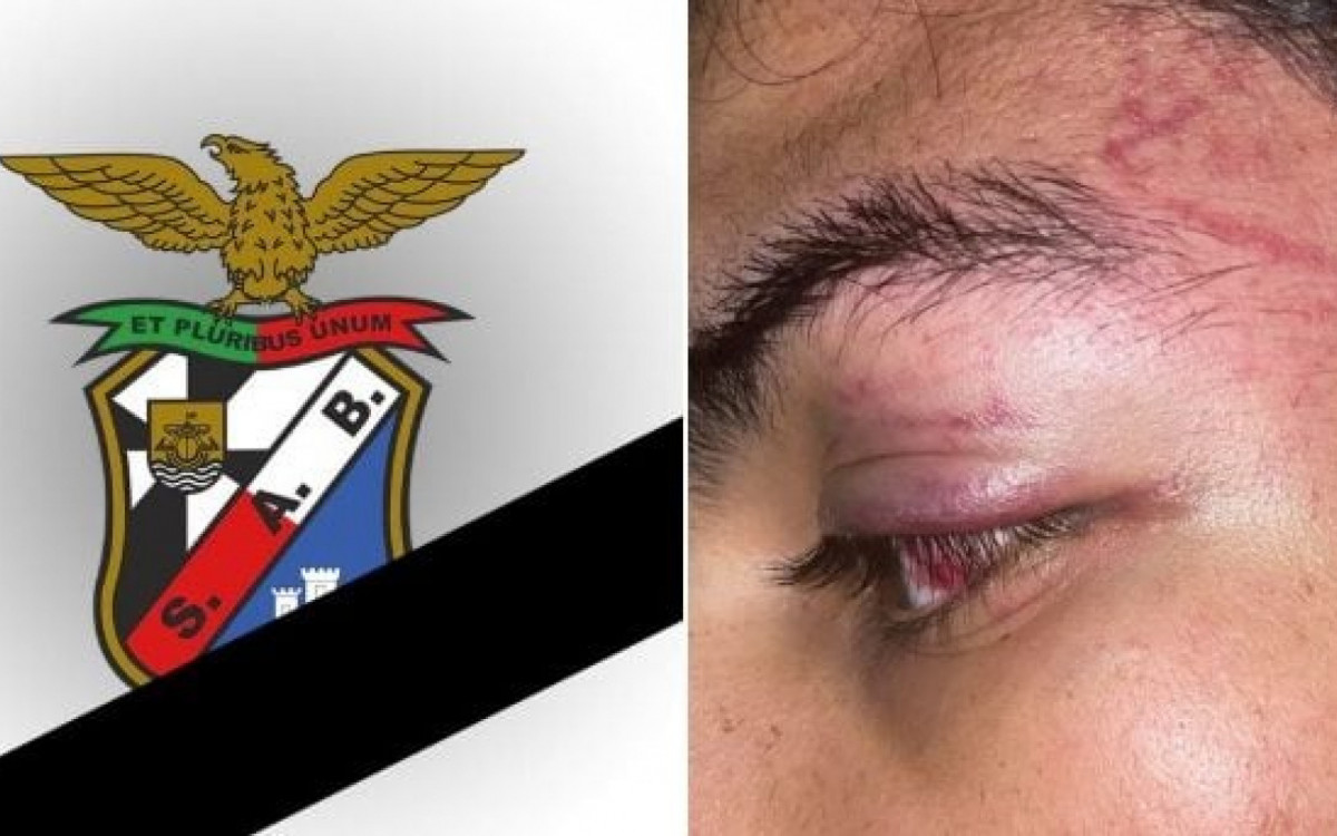 Jogadores s&atilde;o agredidos e roubados por advers&aacute;rios ap&oacute;s partida