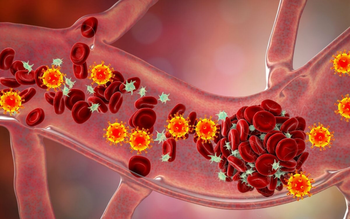 Diagn&oacute;stico precoce de trombofilia evita complica&ccedil;&otilde;es graves (Imagem: Kateryna Kon | Shutterstock) 