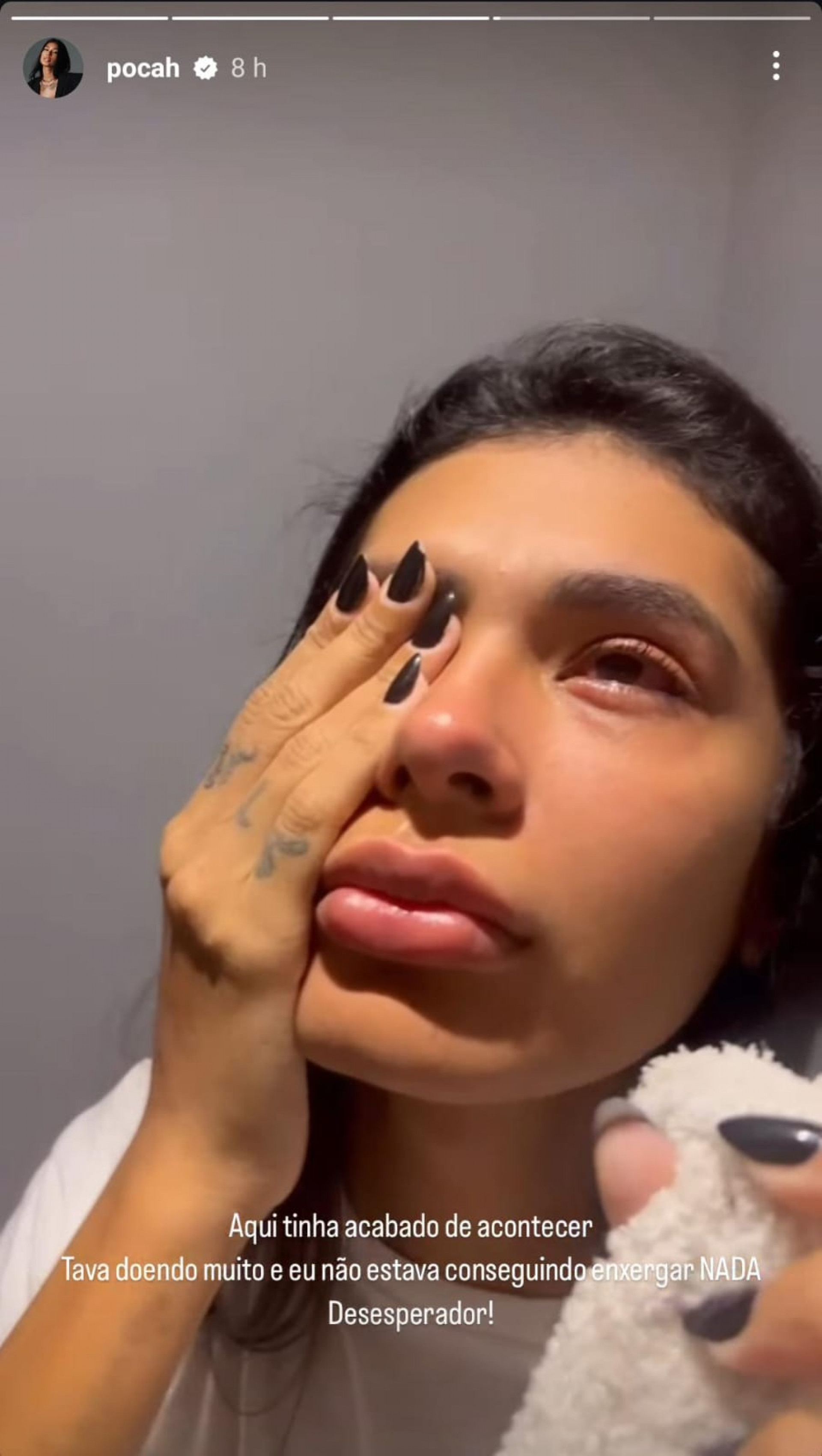 Pocah sofre acidente enquanto se preparava para apresentação: 'Muita dor' - Reprodução / Instagram