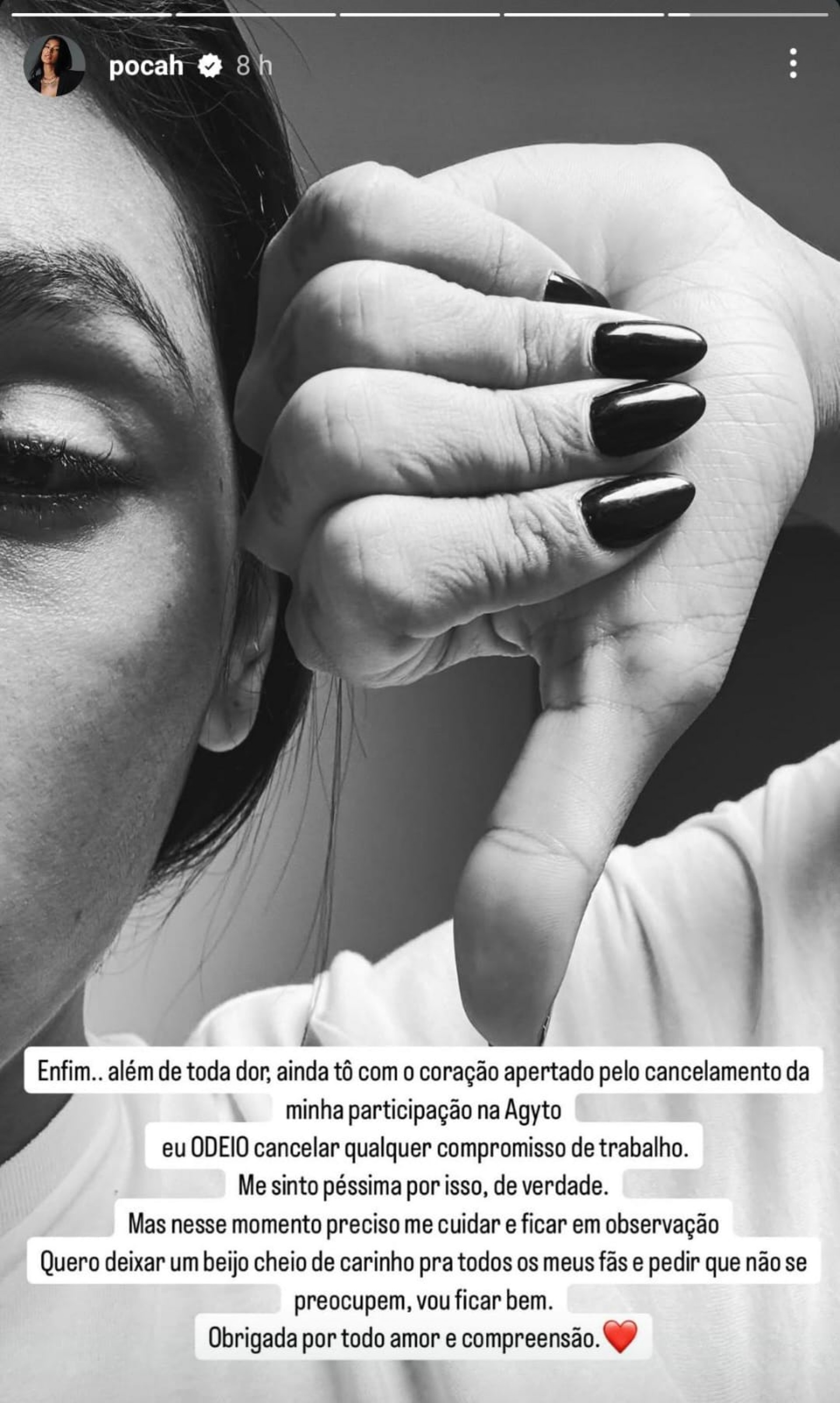 Pocah sofre acidente enquanto se preparava para apresentação: 'Muita dor' - Reprodução / Instagram