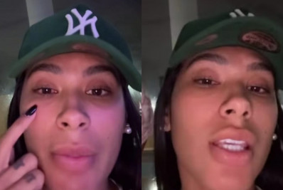 Pocah atualiza estado de saúde após perda temporária da visão