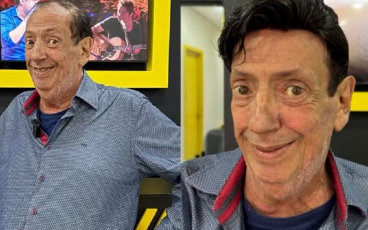 Veja o antes e depois do ator Marcos Oliveira 