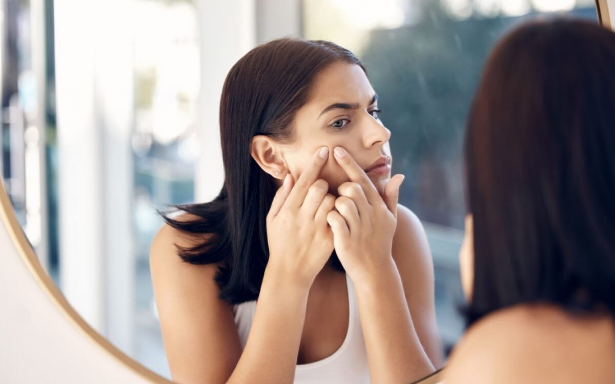A acne na vida adulta &eacute; comum e pode ser tratada com cuidados espec&iacute;ficos (Imagem: PeopleImages.com - Yuri A | Shutterstock) 