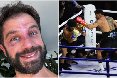 Duda Nagle mostra rosto com hematomas após perder luta para Popó