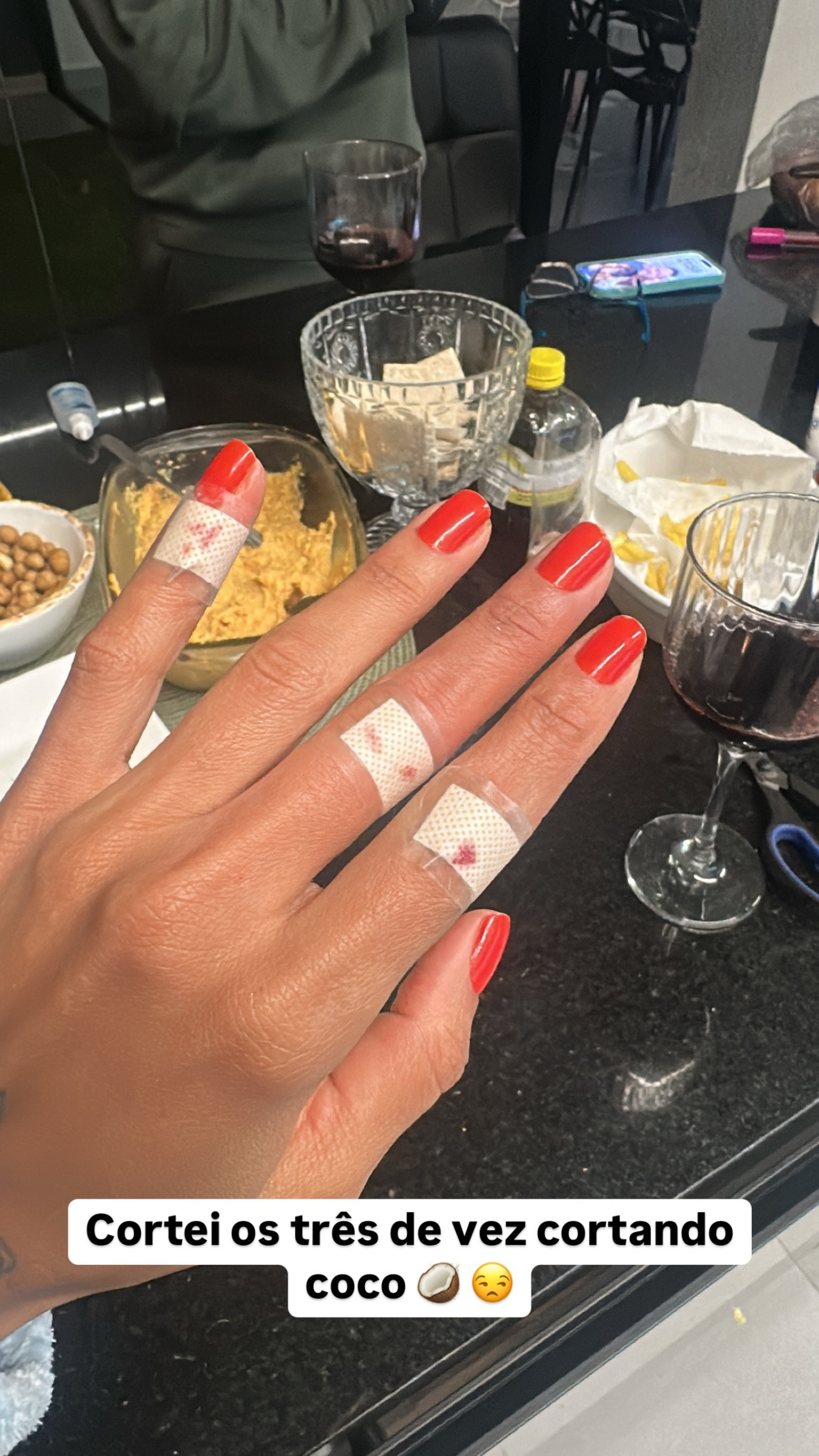 Tays Reis mostra cortes nos dedos ap&oacute;s acidente - Foto: Reprodu&ccedil;&atilde;o