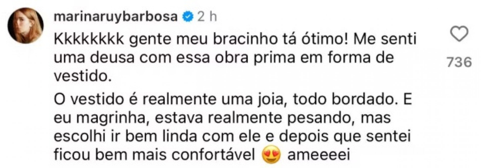 Marina Ruy Barbosa comentou repercussão de hematomas nos ombros  - Reprodução/Instagram