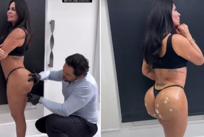 Gretchen faz 'harmonização do bumbum' após deixar o 'Power Couple'; veja