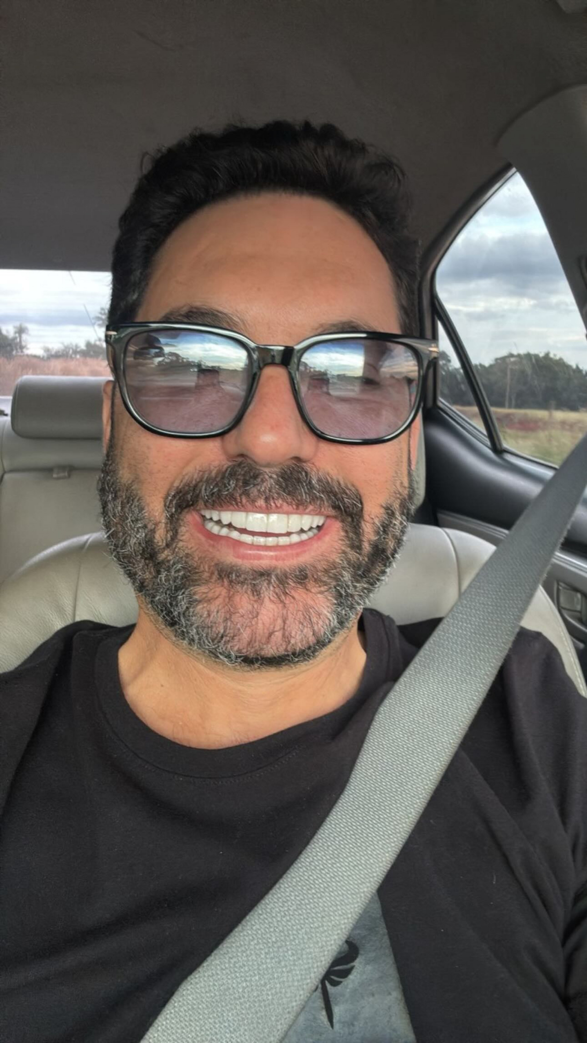 Edson mostrou resultado de implante após perder dente  - Reprodução/Instagram