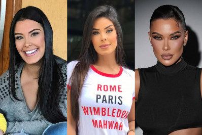 Ex-BBB Ivy Moraes revela quais procedimentos fez no rosto