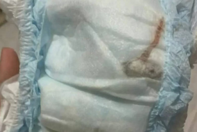 Mãe encontra rato morto dentro de fralda do filho