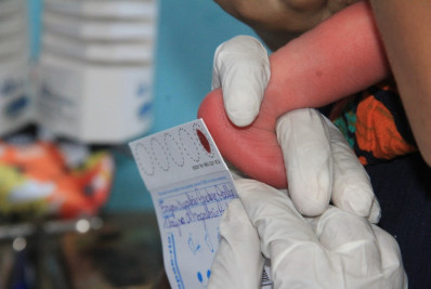 São Gonçalo oferece teste do pezinho em sete unidades e na maternidade municipal