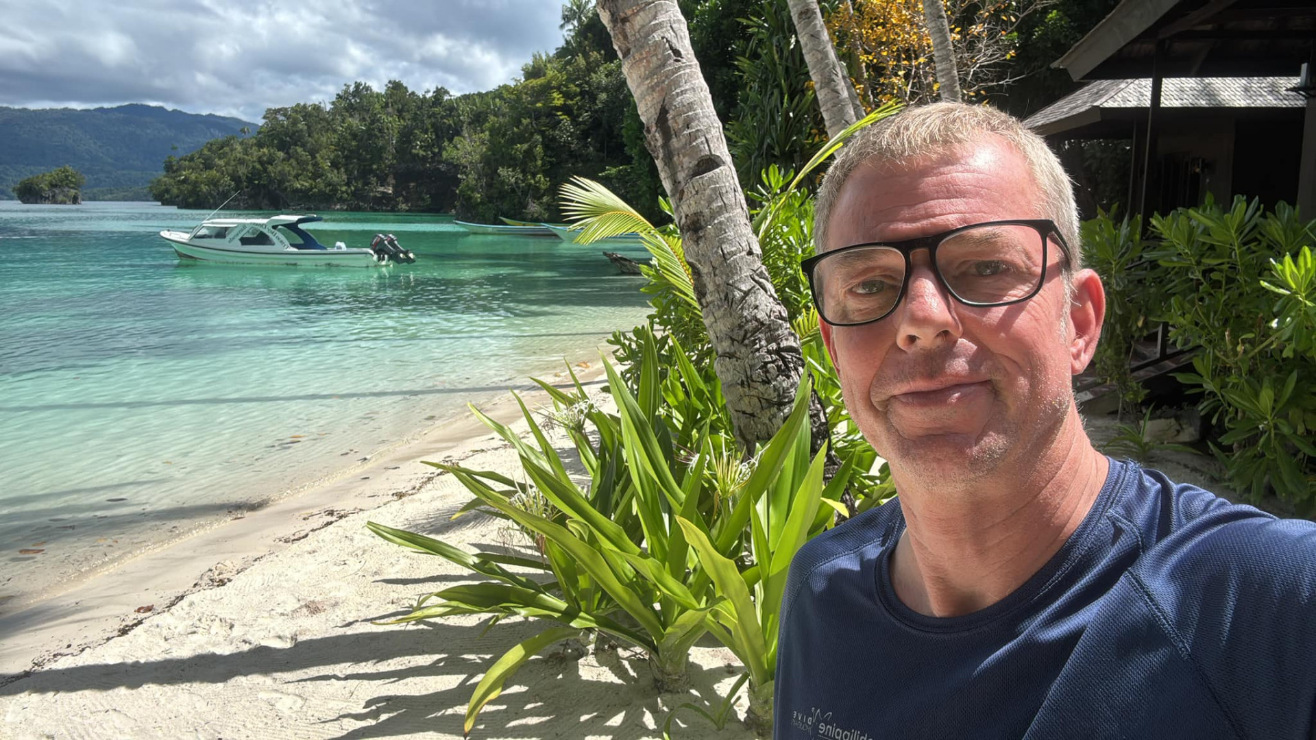 Tony Exall ficou com uma sanguessuga no olho por seis horas - Reprodução / Facebook