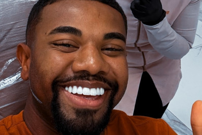 Davi Brito faz harmonização facial e mostra resultado na web