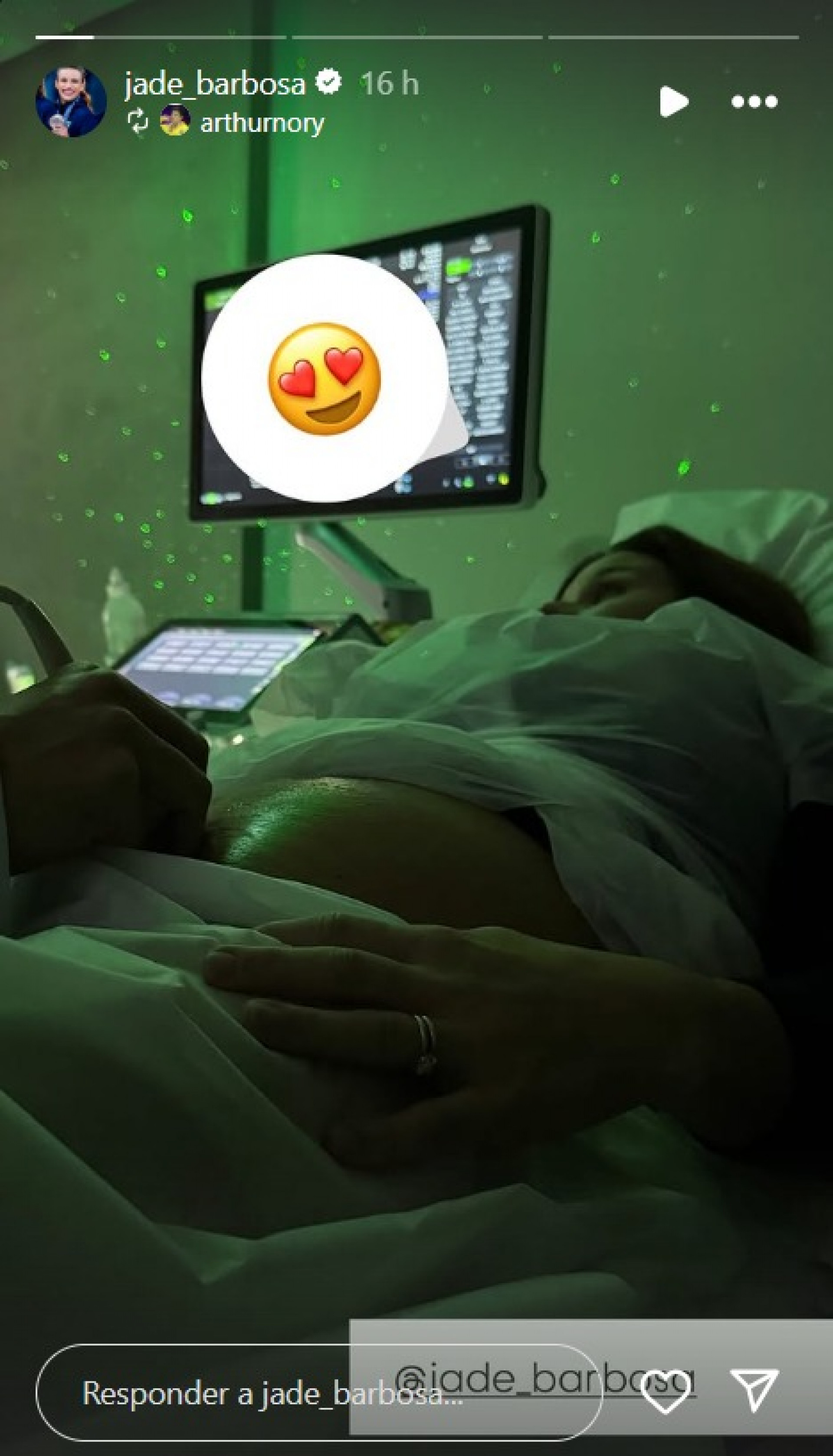 Jade Barbosa mostra barriguinha de grávida durante ultrassom - Reprodução Instagram