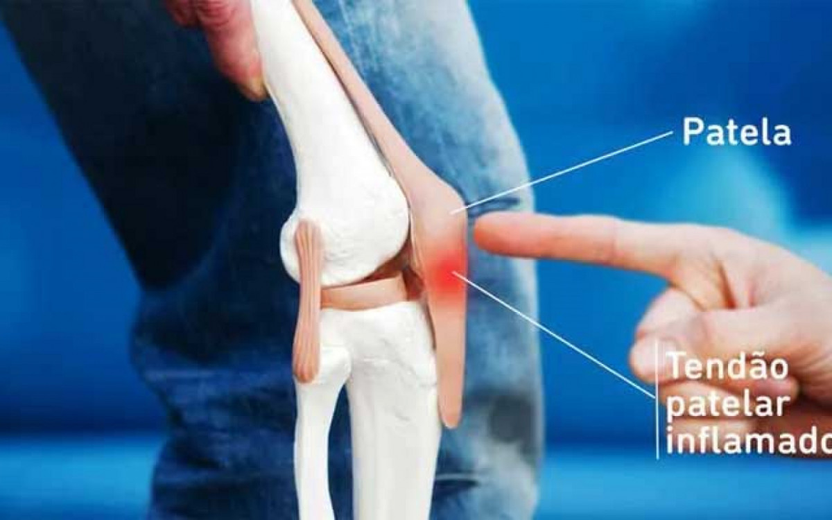 Rodrigo Garro sofre com tendinoplatia patelar no joelho direito