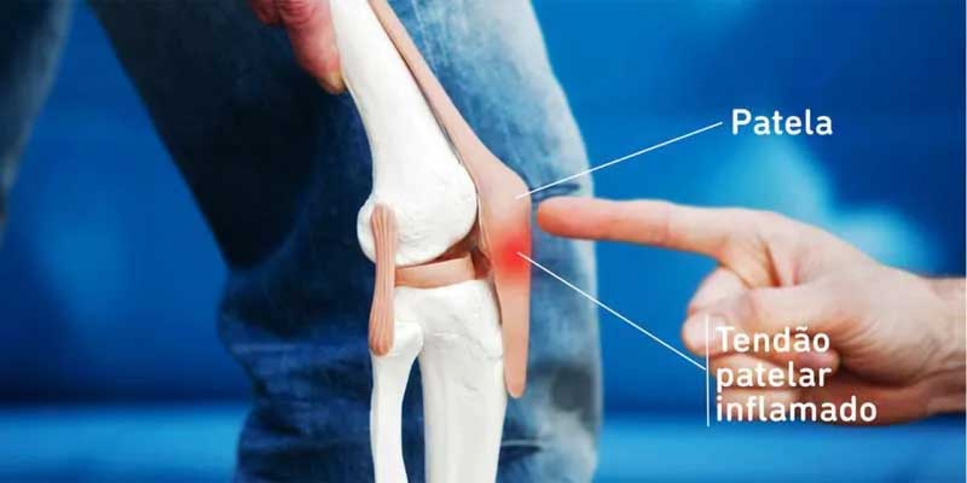 Rodrigo Garro sofre com tendinopatia patelar no joelho direito - Internet