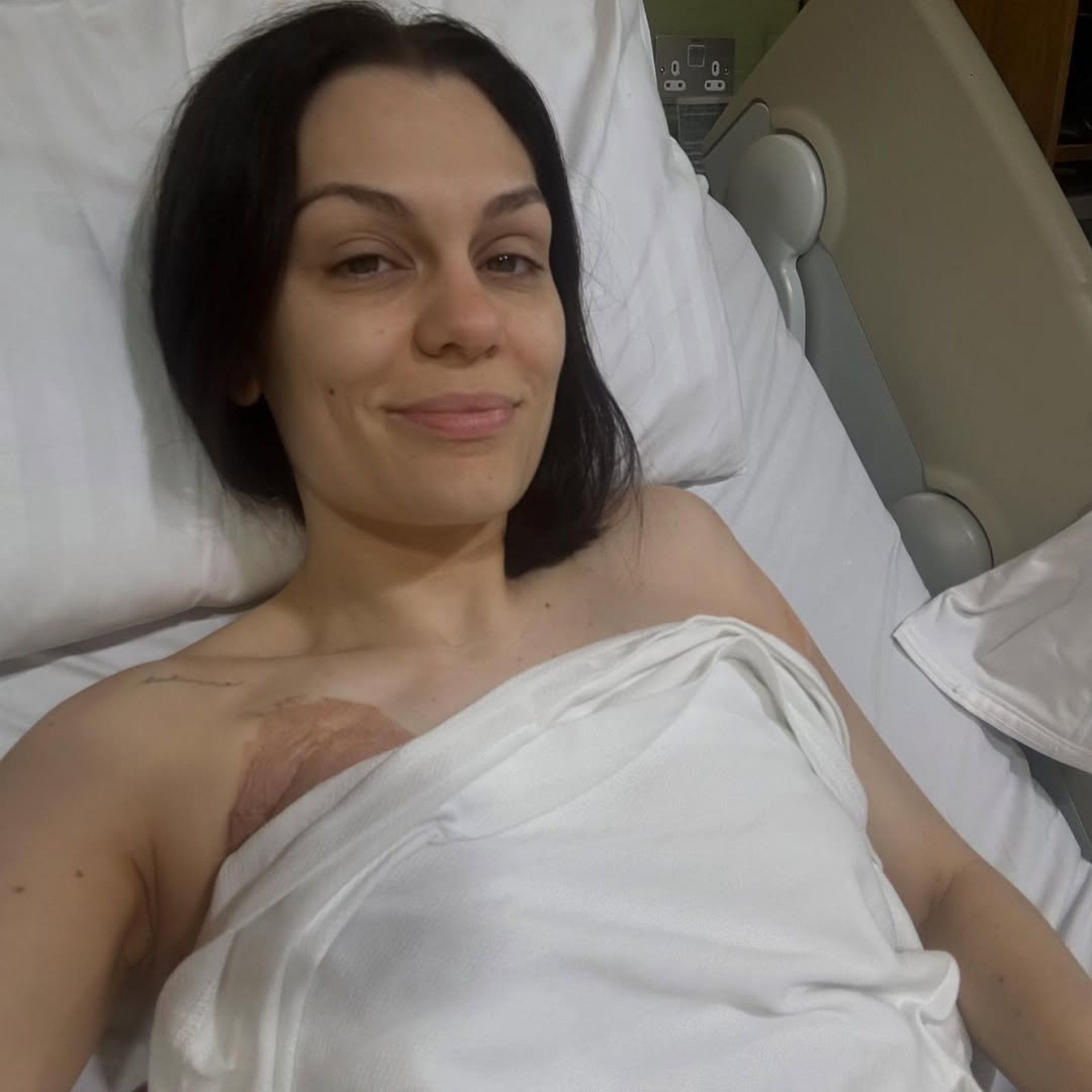 Jessie J foi submetida a cirurgia para tratar câncer de mama - Reprodução/Instagram