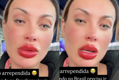 Andressa Urach diz ter se arrependido de cirurgia nos olhos: 'Não enxergava'