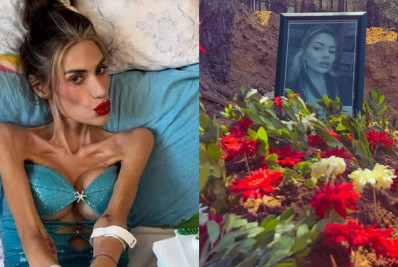 Morre, aos 30 anos, influenciadora que chegou a pesar 22 kg