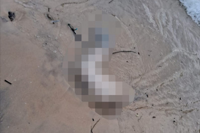 Perna humana é encontrada em praia de Niterói
