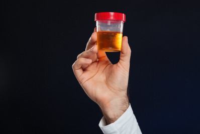 Clínica pede que pacientes parem de enviar amostras de urina 'inadequadas ou não solicitadas'