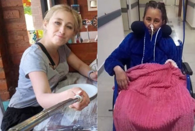 Argentina, internada para laqueadura, tem perna amputada e coração transplantado