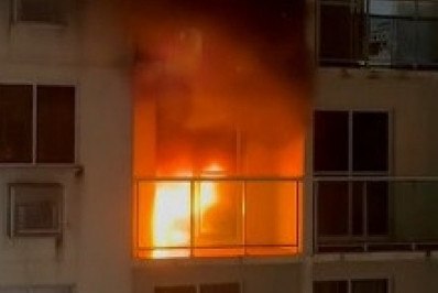 Incêndio em apartamento deixa mulher ferida na Zona Norte