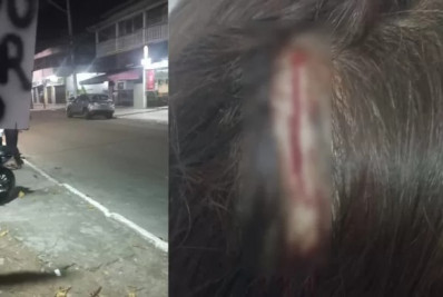 Mulher leva pontos na cabeça ao bater em placa irregular em Cabo Frio