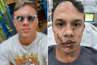 Quem é o personal trainer que foi agredido ao defender vítimas de assédio em bar