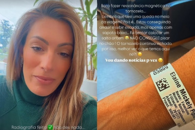 Mulher de Cesar Filho passa por exames após tombo na Itália