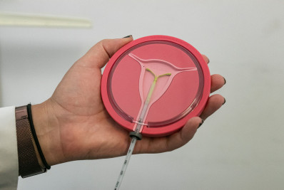 Macaé amplia oferta de DIU hormonal com aquisição de novos dispositivos para saúde da mulher