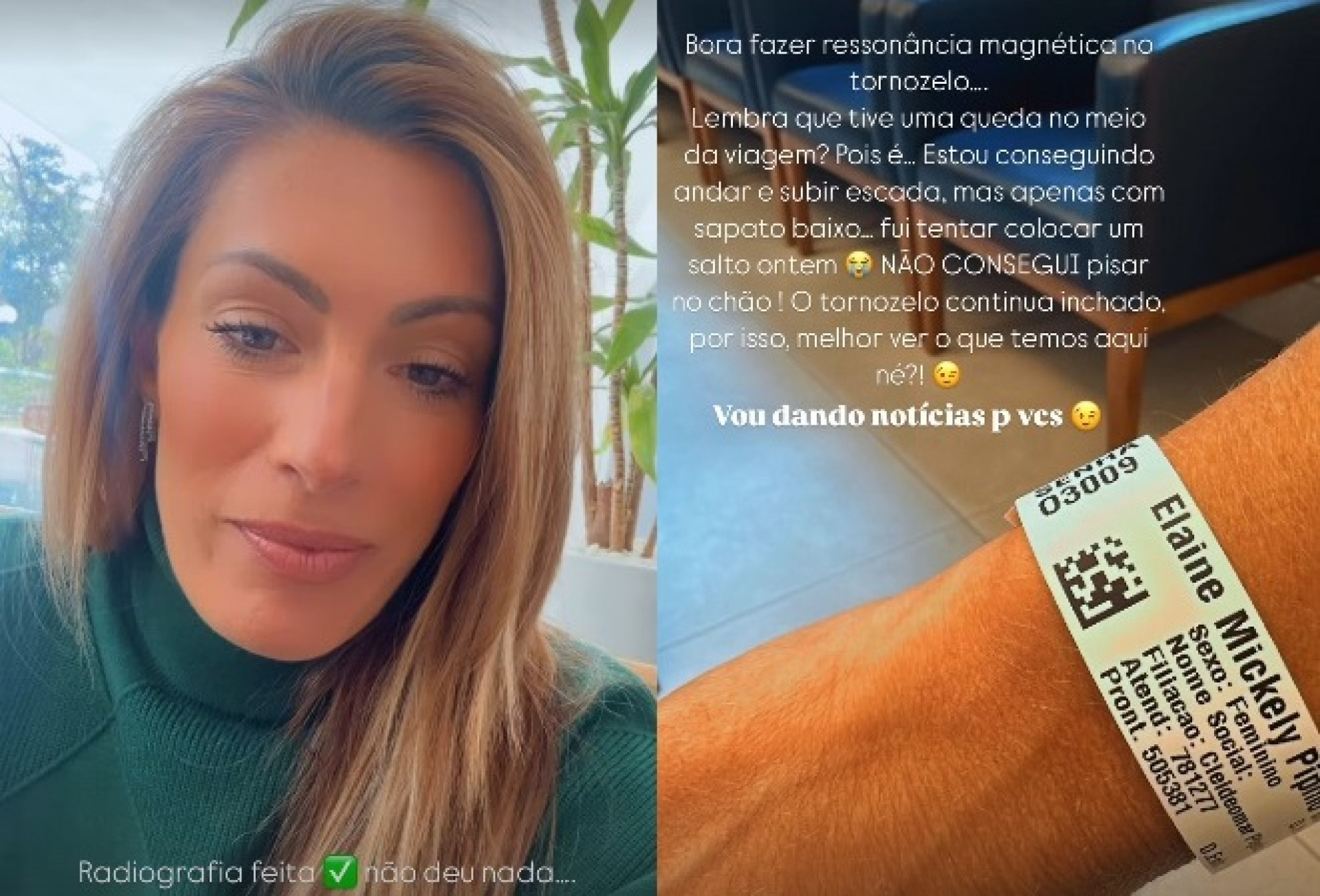 Elaine Mickely passou por exames após tombo - Reprodução/Instagram 
