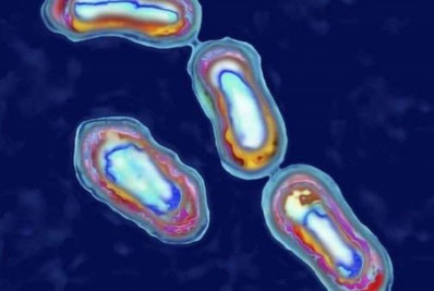 EUA: Paciente morre com bactéria que causou 'Grande Peste' na Idade Média