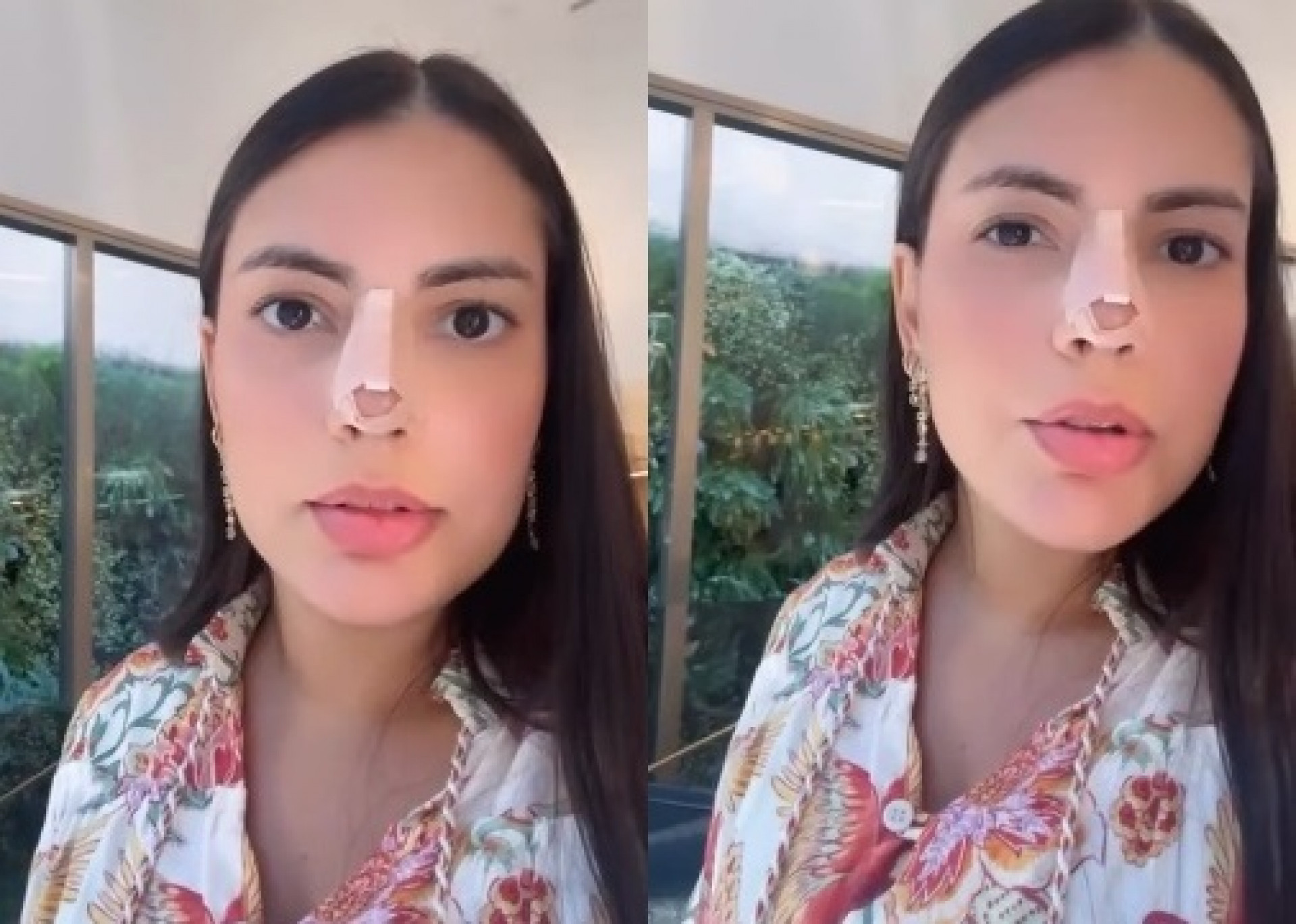 Ex-BBB Fernanda Bande contou detalhes do pós-operatório de rinoplastia  - Reprodução/Instagram 