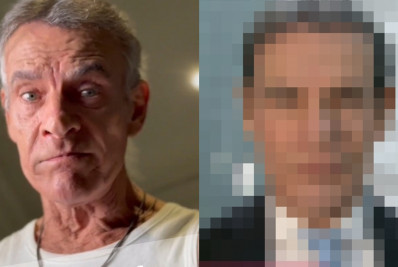 Mário Gomes recebe elogios após passar por harmonização facial