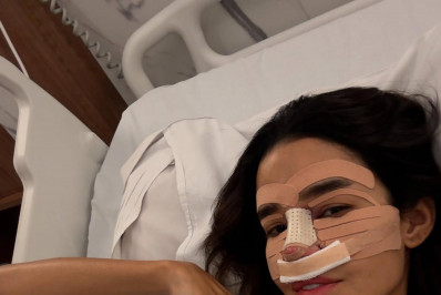 Kerline Cardoso passa por rinoplastia e surge com curativo