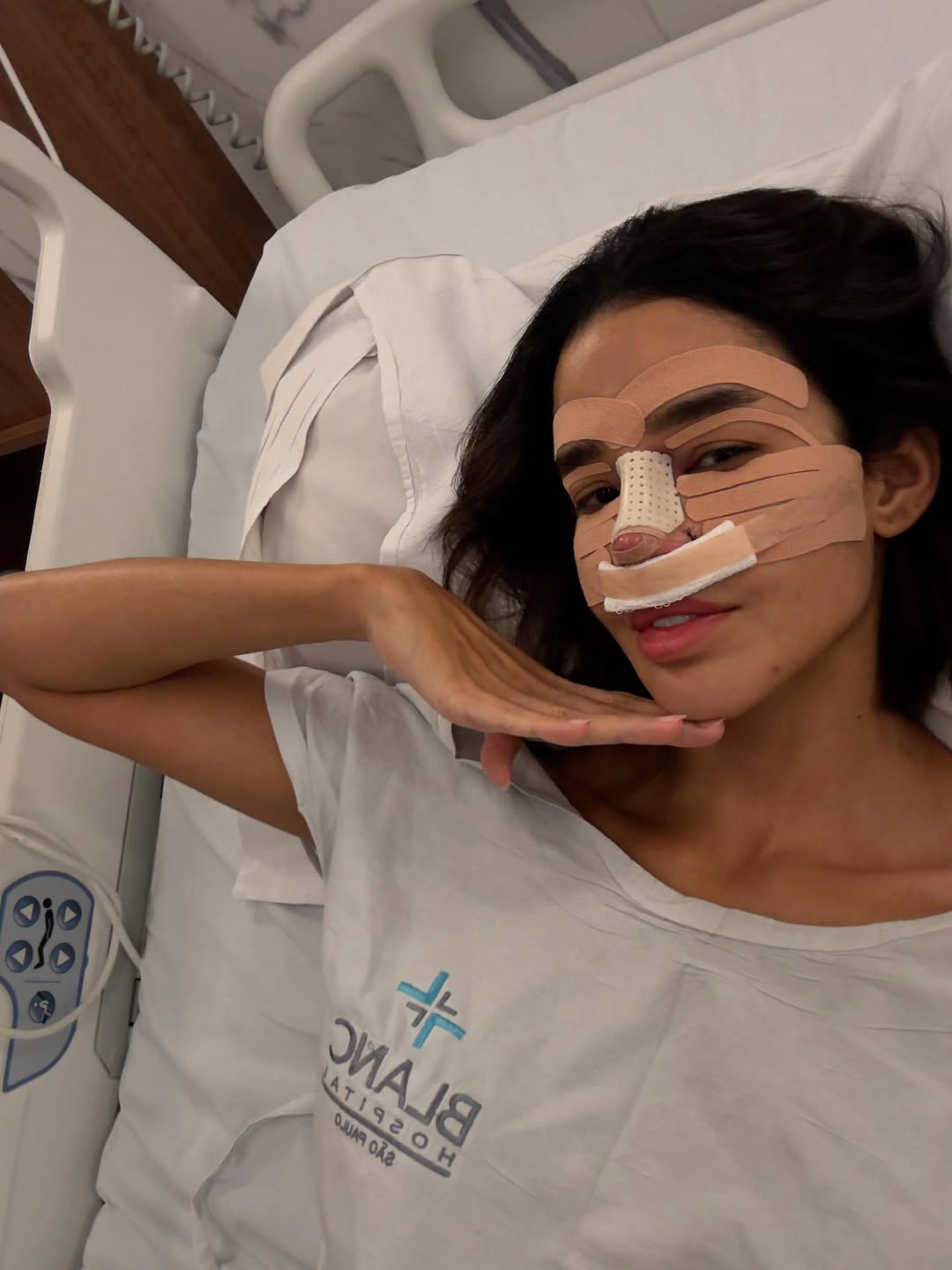 Kerline Cardoso exibiu curativos após rinoplastia  - Reprodução/Instagram