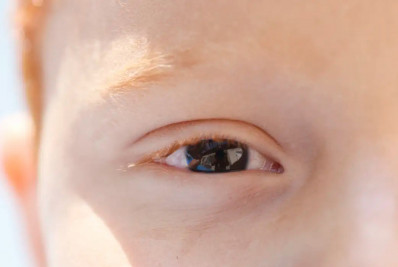 Cartilha sobre saúde ocular na infância orienta pais e professores