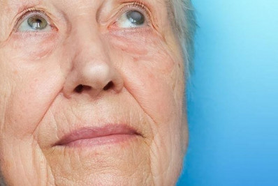 Agosto Cinza: um alerta para prevenção e tratamento da catarata