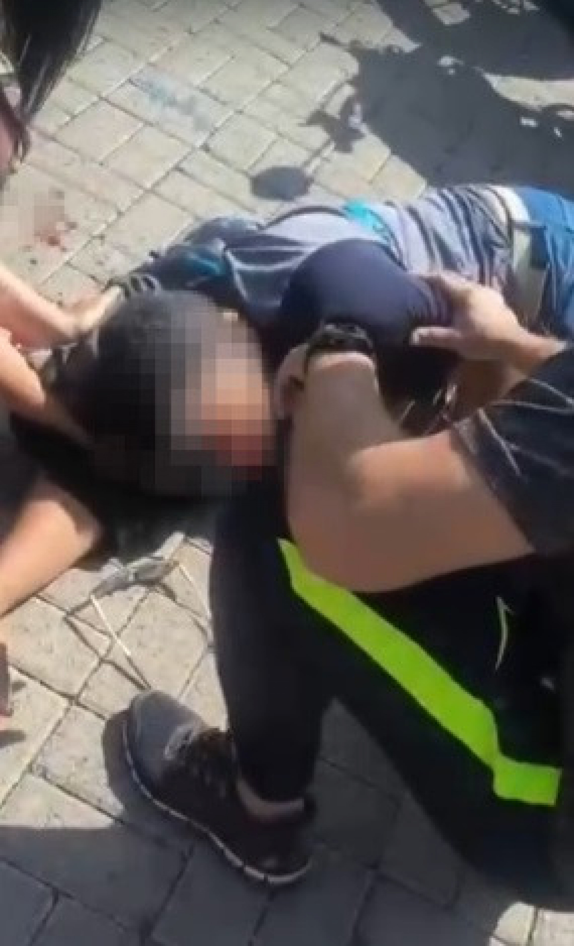 Vítima foi atingida por motocicleta em fuga e corre risco de perder a visão