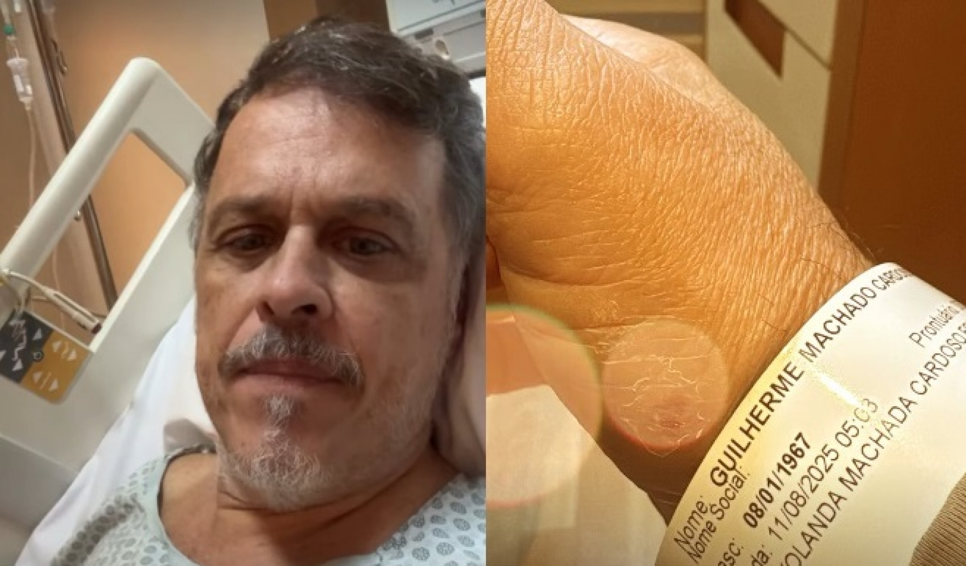 Guilherme Fontes passou por cirurgia no ouvido - Reprodução/Instagram