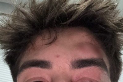 Empresário denuncia ter sido espancado por seguranças de famoso karaokê em SP