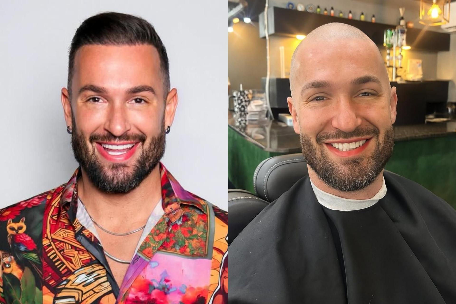 Antes e depois de Diego Hypolito  - Reprodução / Instagram