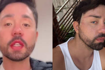 Rico Melquiades rebate críticas após mudar cor dos olhos: 'Hipócrita'