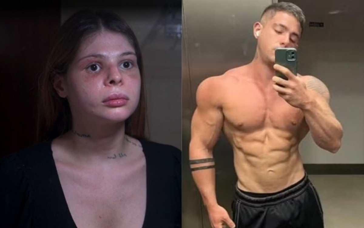 revistapazes.com - Médica é brutalmente agredida pelo namorado no dia do aniversário e relata como teve o rosto desfigurado